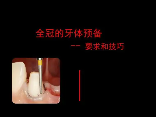 全冠的牙体预备课件-金属全冠牙体预备64页PPT