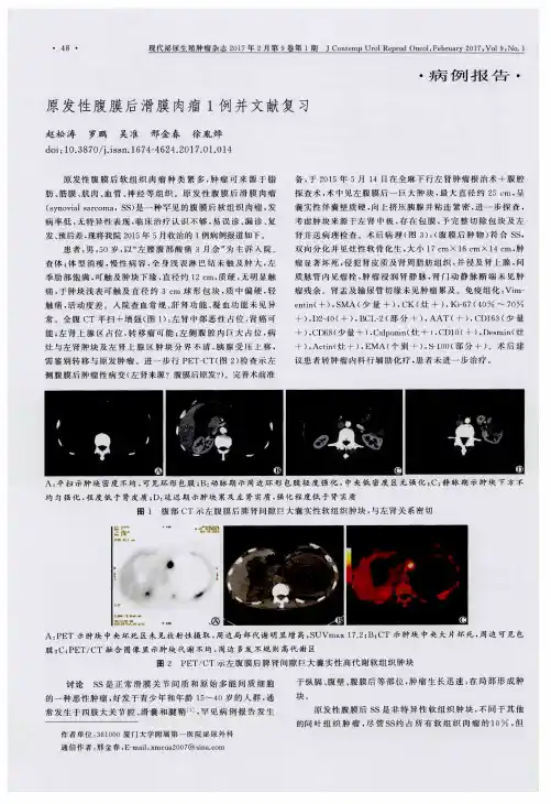 原发性腹膜后滑膜肉瘤1例并文献复习