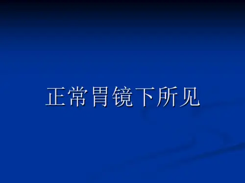 爱爱医资源-胃镜图谱(正常和常见胃病图谱)-36张PPT课件