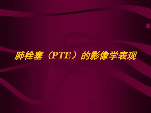 肺栓塞的影像学表现