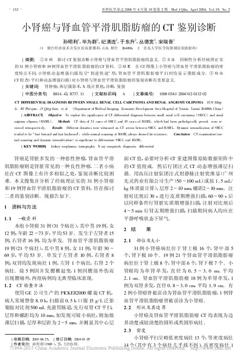 小肾癌与肾血管平滑肌脂肪瘤的CT鉴别诊断_孙明利