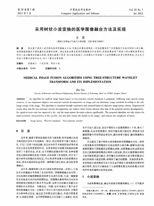 采用树状小波变换的医学图像融合方法及实现
