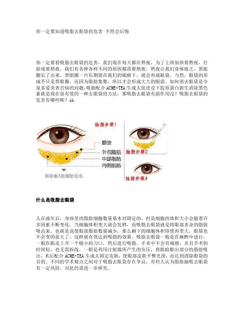 你一定要知道吸脂去眼袋的危害 不然会后悔