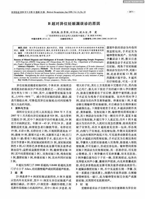 B超对异位妊娠漏误诊的原因