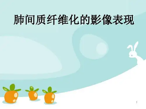 肺间质纤维化的影像表现PPT精选课件