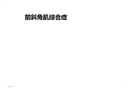 前斜角肌综合症PPT课件