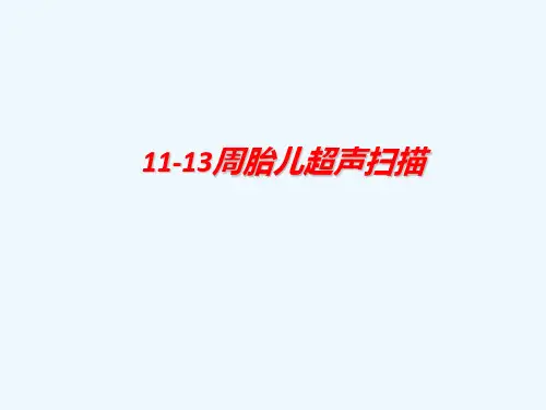 11-13周胎儿超声扫描PPT课件