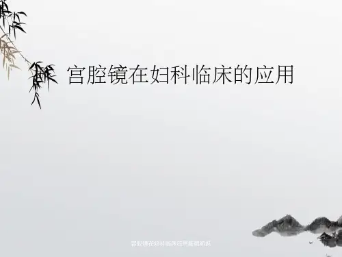 宫腔镜在妇科临床应用基础知识
