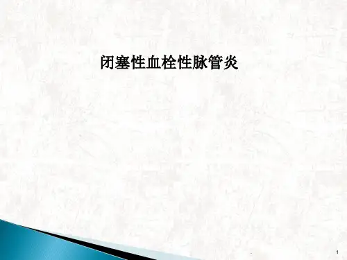 闭塞性血栓性脉管炎ppt演示课件