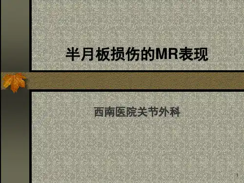 半月板损伤的MRI表现(课堂PPT)