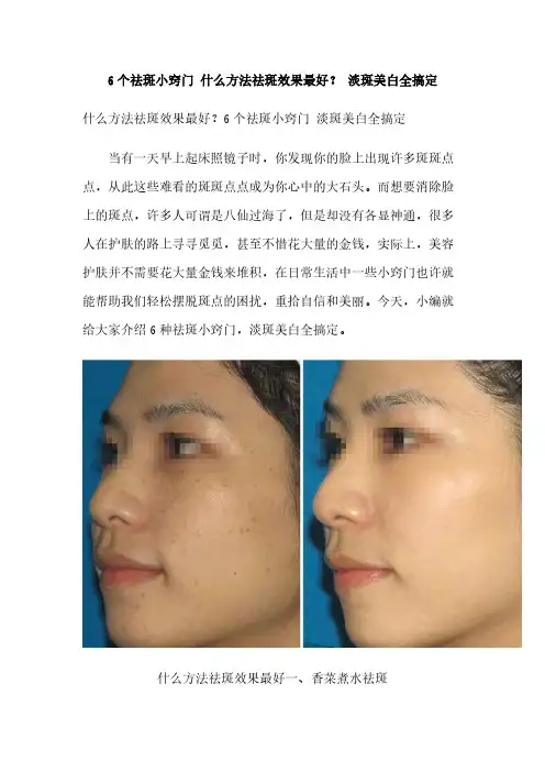 6个祛斑小窍门 什么方法祛斑效果最好？ 淡斑美白全搞定