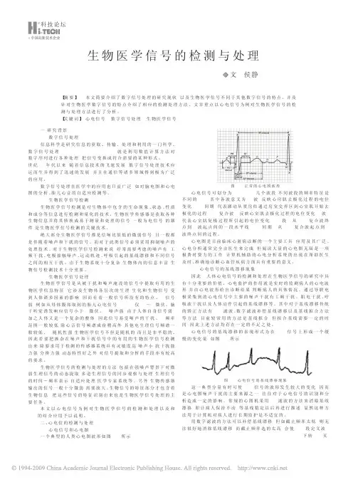 生物医学信号的检测与处理