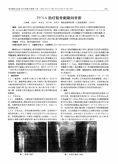 PFNA治疗股骨粗隆间骨折