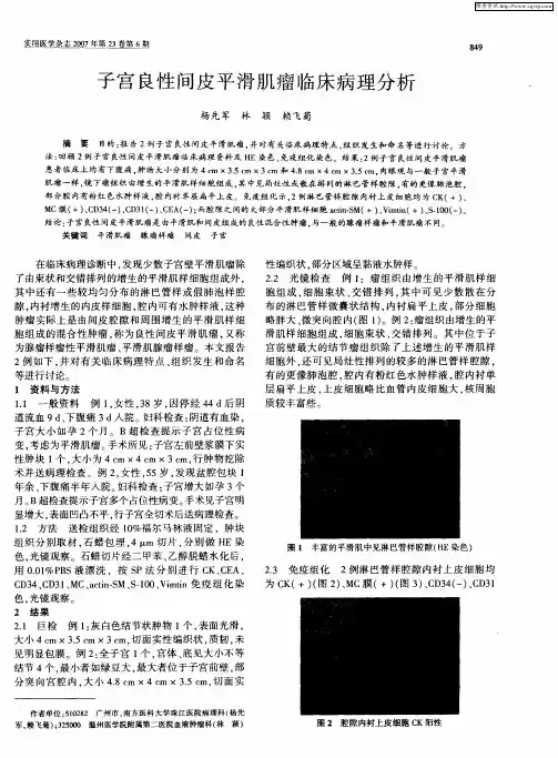 子宫良性间皮平滑肌瘤临床病理分析
