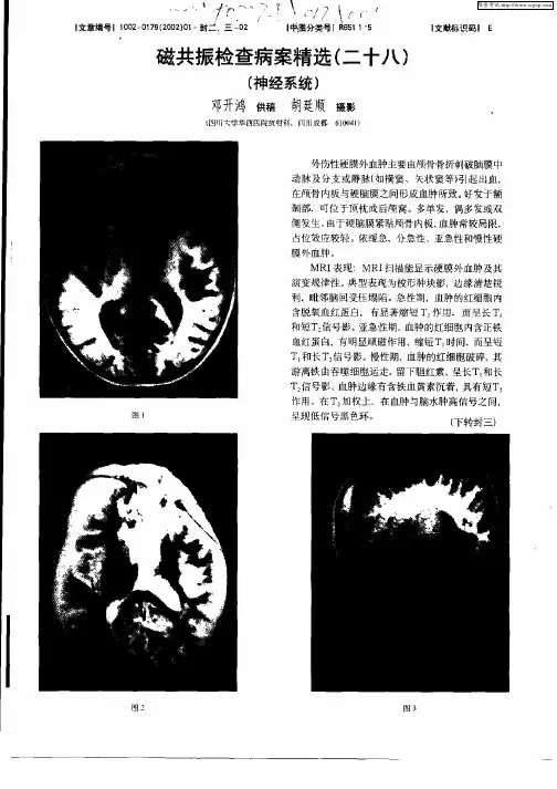 磁共振检查病案精选(二十八)(神经系统)