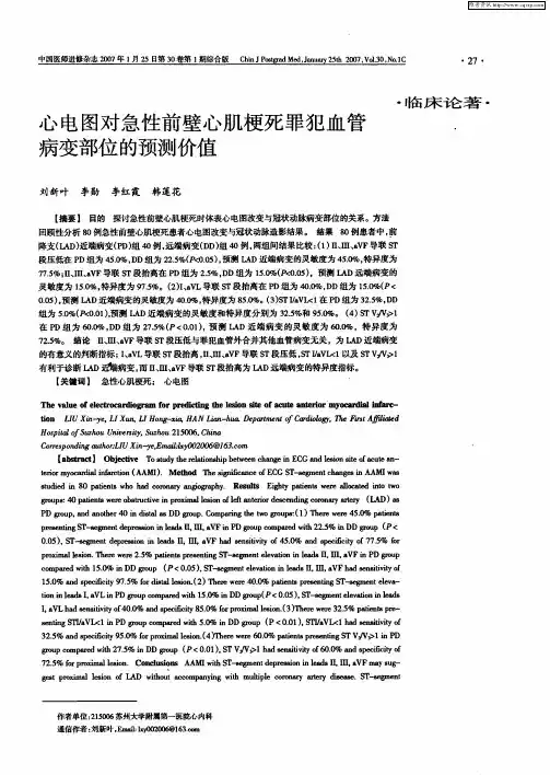 心电图对急性前壁心肌梗死罪犯血管病变部位的预测价值