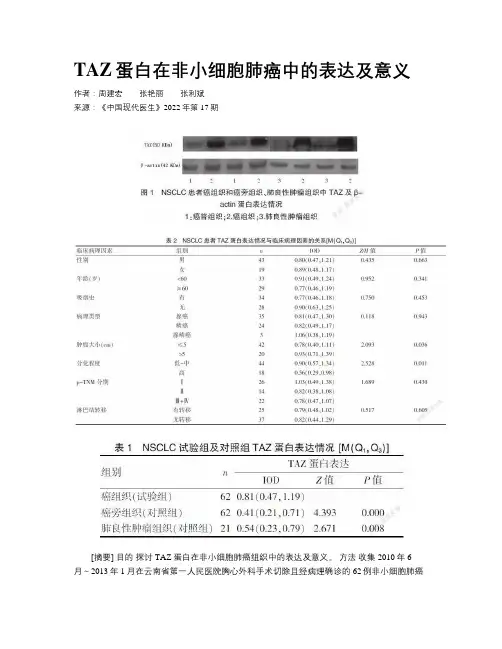 TAZ蛋白在非小细胞肺癌中的表达及意义