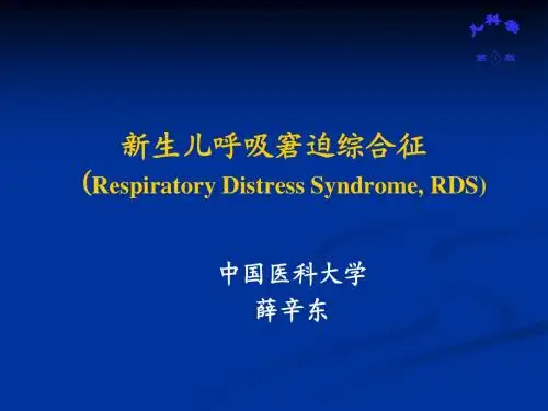 RDS