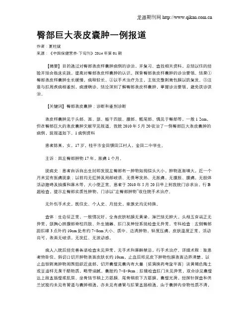 臀部巨大表皮囊肿一例报道