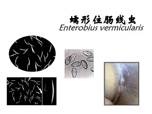 线虫昆虫