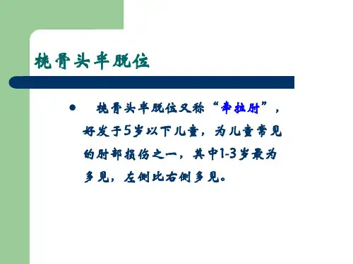 桡骨头半脱位课件
