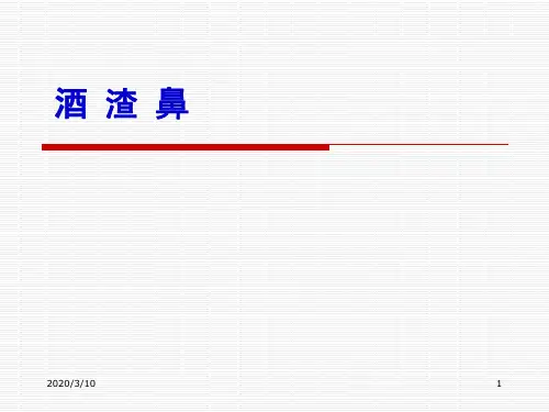 精品医学课件-酒渣鼻