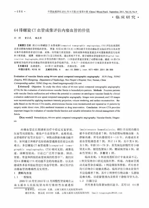 64排螺旋CT血管成像评估内瘘血管的价值