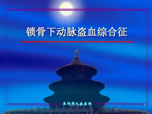 锁骨下动脉盗血综合征(讲座类)