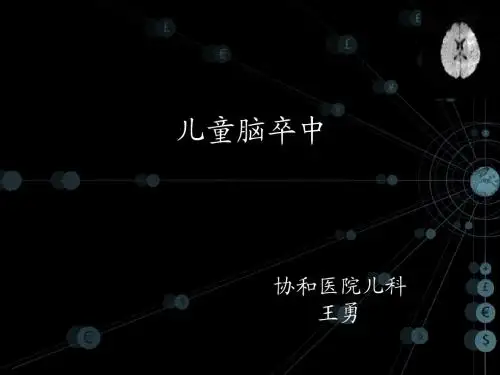 05 儿童脑卒中研究进展