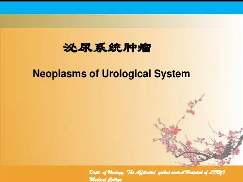 肾细胞癌诊断治疗指南