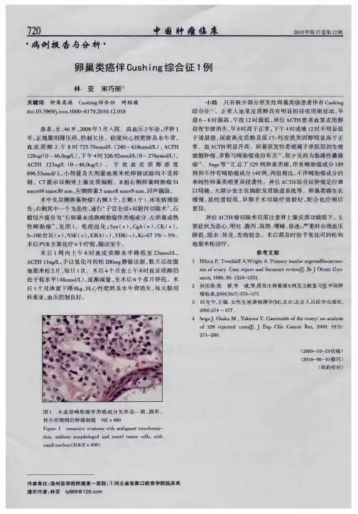 卵巢类癌伴Cushing综合征1例