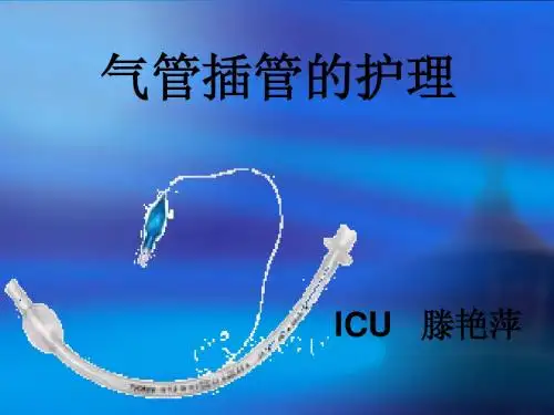 气管插管护理