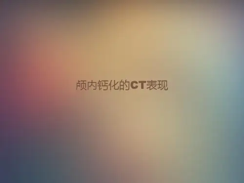 颅内钙化的CT表现