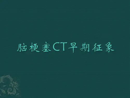 脑梗塞CT早期征象