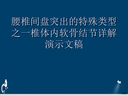 腰椎间盘突出的特殊类型之一椎体内软骨结节详解演示文稿