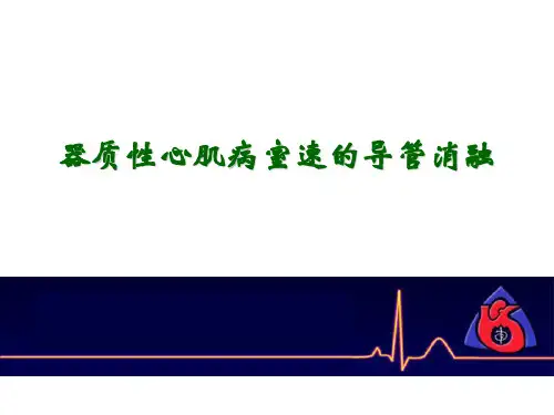 器质性心肌病室速的导管消融