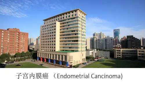妇产科学--子宫内膜癌