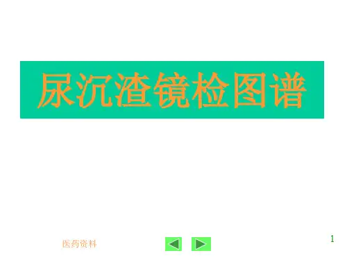 尿沉渣镜检图谱(培训)