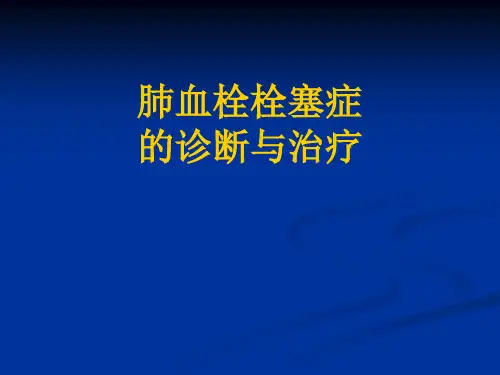 肺栓塞(2014年2月28日小讲课)