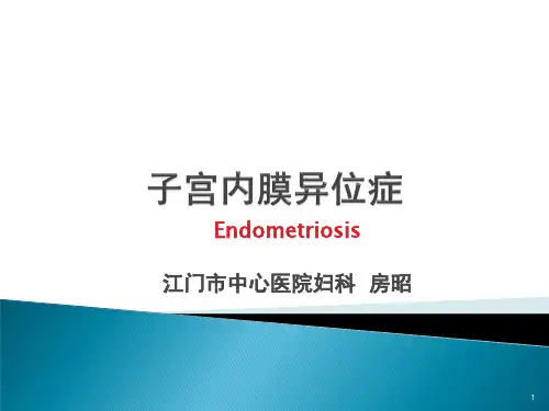 子宫内膜异位症PPT参考幻灯片
