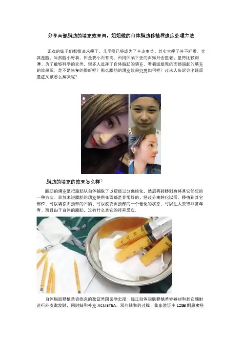 分享面部脂肪填充效果图,姐姐做的自体脂肪移植后遗症处理方法