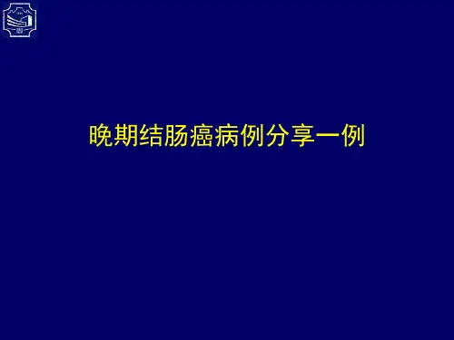6.结肠癌典型病例讨论一例