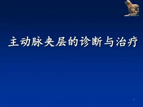 主动脉夹层的诊断和治疗PPT课件
