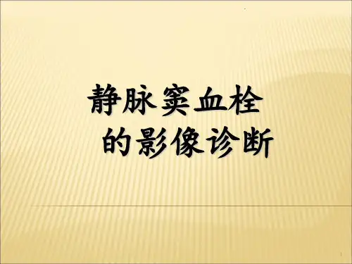 静脉窦血栓的影像诊断ppt课件