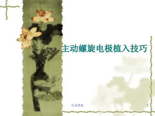 主动螺旋导线植入技巧[行业荟萃]
