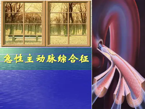 急性主动脉综合征-PPT课件