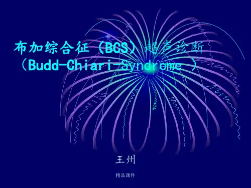 布加综合征超声诊断最新版本