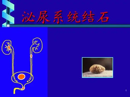 2014版肾结石诊疗指南 ppt课件